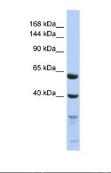 Western blot of Human 293T . TEX11 antibody dilution 1.0 ug/ml.
