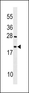 TEX12 Antibody western blot of mouse heart tissue lysates (35 ug/lane). The TEX12 antibody detected the TEX12 protein (arrow).