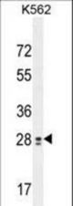 TEX13B Antibody western blot of K562 cell line lysates (35 ug/lane). The TEX13B antibody detected the TEX13B protein (arrow).