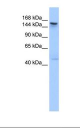 Fetal muscle cell lysate. Antibody concentration: 1.0 ug/ml. Gel concentration: 6%-18%.
