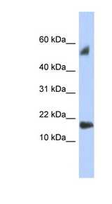 TEX19 antibody LS-C111775 Western blot of Placenta lysate.