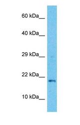 Western blot of TEX19 Antibody with human Stomach Tumor lysate.