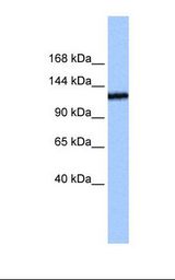 Jurkat cell lysate. Antibody concentration: 0.5 ug/ml. Gel concentration: 6%-18%.