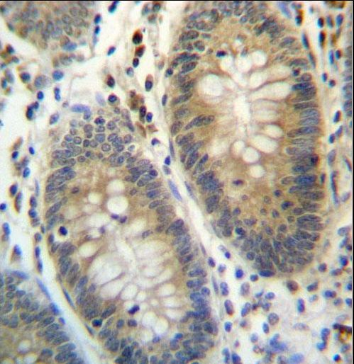 TEX261 Antibody immunohistochemistry of formalin-fixed and paraffin-embedded human colon tissue followed by peroxidase-conjugated secondary antibody and DAB staining.