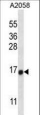 TEX261 Antibody western blot of A2058 cell line lysates (35 ug/lane). The TEX261 antibody detected the TEX261 protein (arrow).