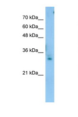 TEX264 antibody LS-C111135 Western blot of Jurkat Cell lysate. Antibody concentration 1 ug/ml.