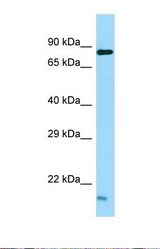 Western blot of Human NCI-H226. Tex35 antibody dilution 1.0 ug/ml.