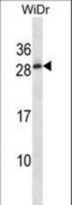 C11orf20 Antibody western blot of WiDr cell line lysates (35 ug/lane). The C11orf20 antibody detected the C11orf20 protein (arrow).