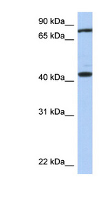 TEX9 antibody LS-C111740 Western blot of Fetal Brain lysate.