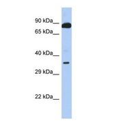 Western blot of Human 721_B. TEX9 antibody dilution 1.0 ug/ml.