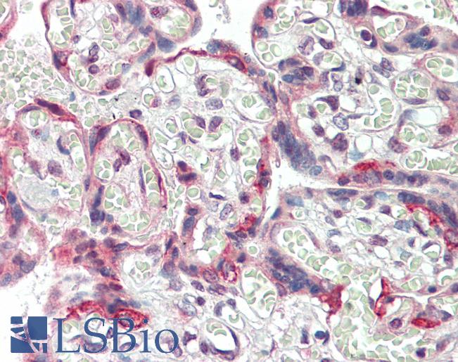 Human, Placenta:Formalin-Fixed Paraffin-Embedded (FFPE)