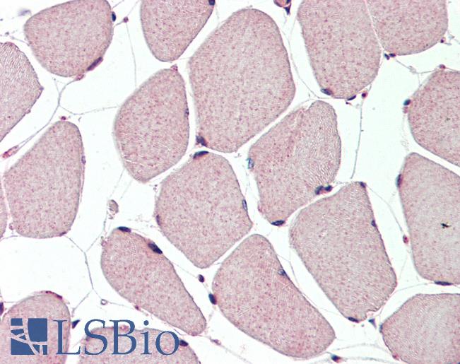 Human, Skeletal muscle: Formalin-Fixed Paraffin-Embedded (FFPE)