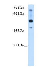 Transfected 293T cell lysate. Antibody concentration: 1.0 ug/ml. Gel concentration: 12%.