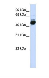 Transfected 293T cell lysate. Antibody concentration: 1.0 ug/ml. Gel concentration: 12%.