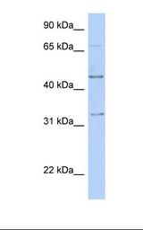 Fetal muscle lysate. Antibody concentration: 1.0 ug/ml. Gel concentration: 12%.