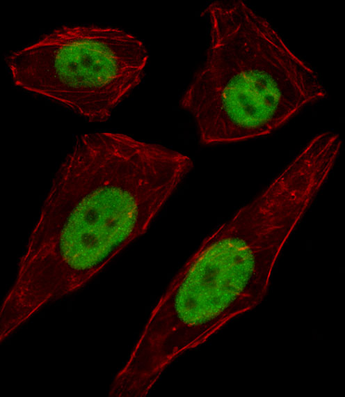 Fluorescent image of A549 cell stained with TFAP2D Antibody. A549 cells were fixed with 4% PFA (20 min), permeabilized with Triton X-100 (0.1%, 10 min), then incubated with TFAP2D primary antibody (1:25, 1 h at 37°C). For secondary antibody, Alexa Fluor 488 conjugated donkey anti-rabbit antibody (green) was used (1:400, 50 min at 37°C). Cytoplasmic actin was counterstained with Alexa Fluor 555 (red) conjugated Phalloidin (7units/ml, 1 h at 37°C). TFAP2D immunoreactivity is localized to Nucleus significantly.