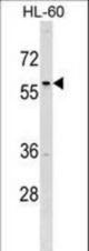 TFAP2D Antibody western blot of HL-60 cell line lysates (35 ug/lane). The TFAP2D antibody detected the TFAP2D protein (arrow).