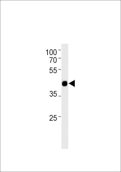Mouse Tcfap2d Antibody western blot of mouse heart tissue lysates (35 ug/lane). The Mouse Tcfap2d antibody detected the Mouse Tcfap2d protein (arrow).