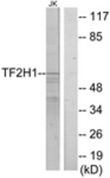 Western blot of extracts from Jurkat cells, using TF2H1 Antibody. The lane on the right is treated with the synthesized peptide.
