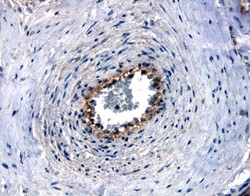 Nectin-4 in Human Placenta. Nectin-4 was detected in immersion fixed paraffin-embedded sections of human placenta using 10 ug/ml Goat Anti-Human Nectin-4 Antigen Affinity-purified Polyclonal Antibody overnight at 4°C. Before incubation with the primary antibody tissue was subjected to heat-induced epitope retrieval using Antigen Retrieval Reagent-Basic. Tissue was stained with Anti-Goat HRP-DAB (brown) and counterstained with hematoxylin (blue).