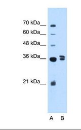 Lane A: Marker. Lane B: 721_B_Iymphoblasts cell lysate. Antibody concentration: 2.5 ug/ml. Gel concentration: 12%.