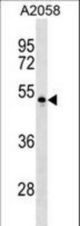 PVRL4 Antibody western blot of A2058 cell line lysates (35 ug/lane). The PVRL4 antibody detected the PVRL4 protein (arrow).