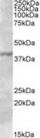 TFB1M antibody (0.3 ug/ml) staining of A431 lysate (35 ug protein in RIPA buffer). Primary incubation was 1 hour. Detected by chemiluminescence.