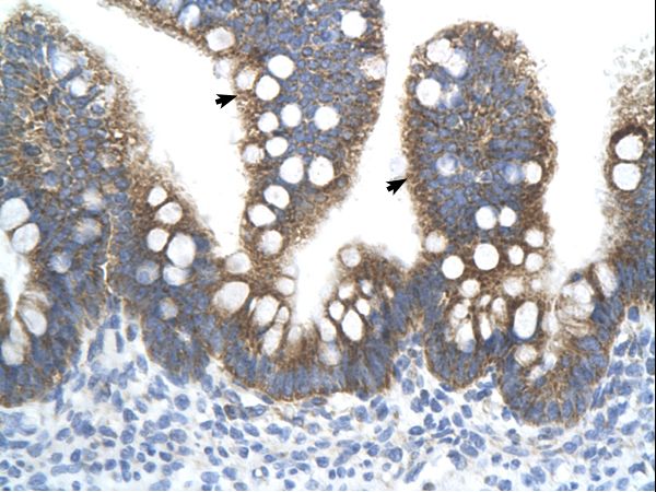 TFB2M antibody LS-C80090 was used in IHC to stain formalin-fixed, paraffin-embedded human intestine.