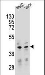 TFB2M Antibody western blot of K562,WiDr cell line lysates (35 ug/lane). The TFB2M antibody detected the TFB2M protein (arrow).