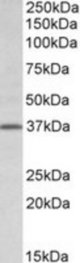 TFB2M antibody (0.5 ug/ml) staining of Rat Lung lysate (35 ug protein/ml in RIPA buffer). Primary incubation was 1 hour. Detected by chemiluminescence.