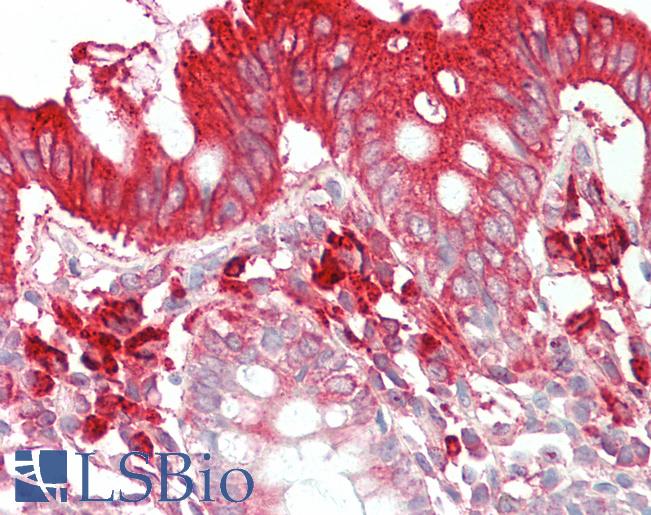 Anti-TFB2M antibody IHC staining of human colon. Immunohistochemistry of formalin-fixed, paraffin-embedded tissue after heat-induced antigen retrieval. Antibody LS-B11146 concentration 5 ug/ml.