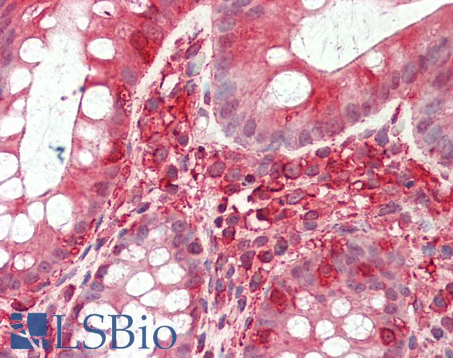 Human, Colon: Formalin-Fixed Paraffin-Embedded (FFPE)