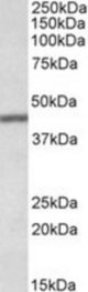 TFB2M antibody (0.1 ug/ml) staining of Human Lung lysate (35 ug protein/ml in RIPA buffer). Primary incubation was 1 hour. Detected by chemiluminescence.