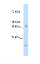 Transfected 293T cell lysate. Antibody concentration: 5.0 ug/ml. Gel concentration: 12%.