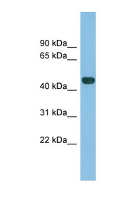 TFB2M antibody LS-C116171 Western blot of Fetal Spleen lysate.