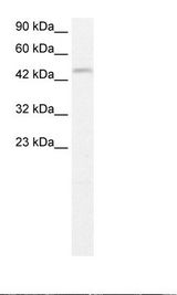 Jurkat Cell Lysate