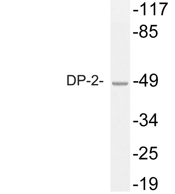 Western blot of DP-2 antibody in extracts from COS7 cells.