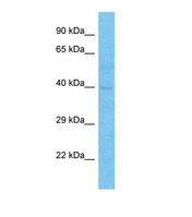 Western blot of Human Thyroid Tumor. TFDP2 antibody dilution 1.0 ug/ml.
