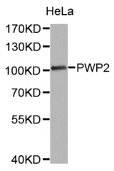 Western blot analysis of extracts of HeLa cell lines, using PWP2 antibody.