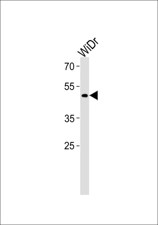 TFDP3 Antibody western blot of WiDr cell line lysates (35 ug/lane). The TFDP3 antibody detected the TFDP3 protein (arrow).