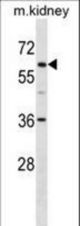 TFE3 Antibody western blot of mouse kidney tissue lysates (35 ug/lane). The TFE3 Antibody detected the TFE3 protein (arrow).