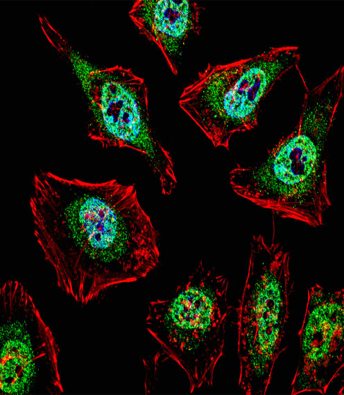 Fluorescent confocal image of HeLa cell stained with TFE3 Antibody. HeLa cells were fixed with 4% PFA (20 min), permeabilized with Triton X-100 (0.1%, 10 min), then incubated with TFE3 primary antibody (1:25, 1 h at 37°C). For secondary antibody, Alexa Fluor 488 conjugated donkey anti-rabbit antibody (green) was used (1:400, 50 min at 37°C). Cytoplasmic actin was counterstained with Alexa Fluor 555 (red) conjugated Phalloidin (7units/ml, 1 h at 37°C). Nuclei were counterstained with DAPI (blue) (10 ug/ml, 10 min). TFE3 immunoreactivity is localized to nucleus and Cytoplasm significantly.