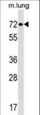 TFE3 Antibody western blot of mouse lung tissue lysates (35 ug/lane). The TFE3 antibody detected the TFE3 protein (arrow).