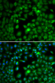 Immunofluorescence blot of MCF7 cell using TFEB antibody. Blue: DAPI for nuclear staining.