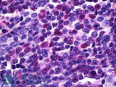 Anti-TFEB antibody IHC of human tonsil. Immunohistochemistry of formalin-fixed, paraffin-embedded tissue after heat-induced antigen retrieval. Antibody LS-B5907 concentration 5 ug/ml.