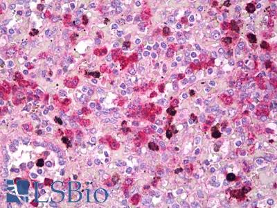 Anti-TFEB antibody IHC of human spleen. Immunohistochemistry of formalin-fixed, paraffin-embedded tissue after heat-induced antigen retrieval. Antibody LS-B7815 dilution 5 ug/ml.