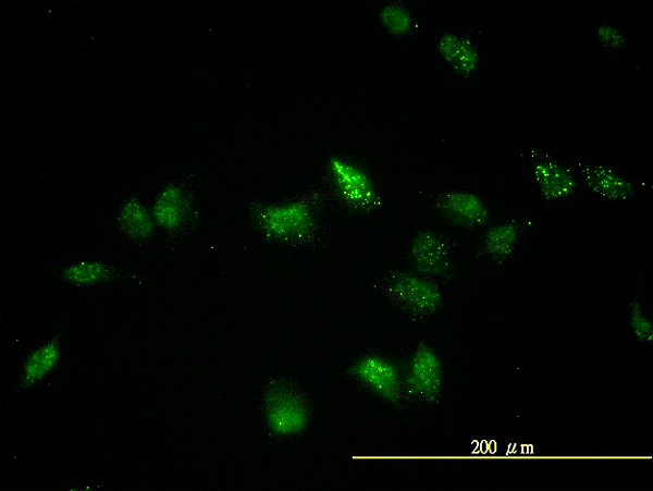Immunofluorescence of monoclonal antibody to TFEB on HeLa cell. [antibody concentration 20 ug/ml]