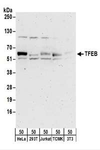 Detection of Human and Mouse TFEB by Western Blot. Samples: Whole cell lysate (50 ug) from HeLa, 293T, Jurkat, TCMK-1, and NIH3T3 cells. Antibodies: Affinity purified rabbit anti-TFEB antibody used for WB at 0.1 ug/ml. Detection: Chemiluminescence with an exposure time of 3 minutes.