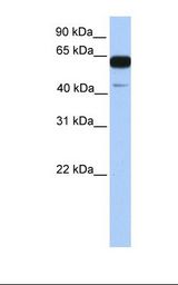 Fetal brain lysate. Antibody concentration: 1.0 ug/ml. Gel concentration: 12%.