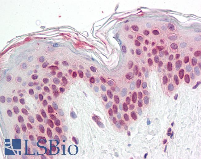Anti-TFEB antibody IHC staining of human skin. Immunohistochemistry of formalin-fixed, paraffin-embedded tissue after heat-induced antigen retrieval.